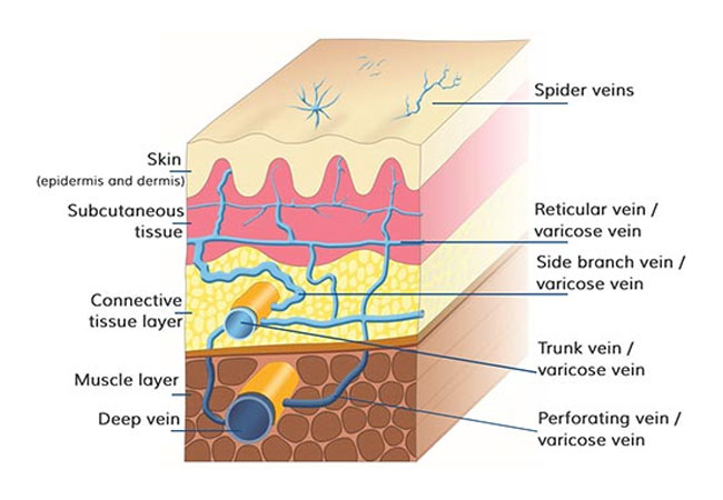 Facial Veins Fairfax
